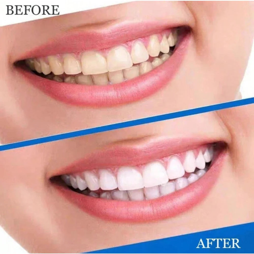 Teeth Whitening strips