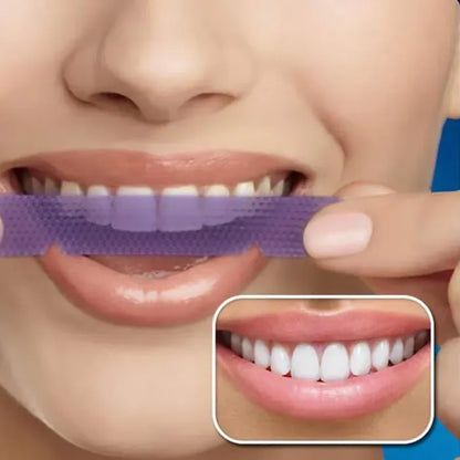 Teeth Whitening strips